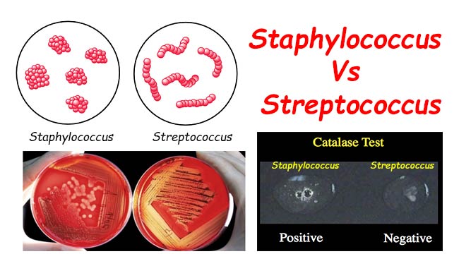 Differences Between Staphylococcus And Streptococcus Microbiology Info Com