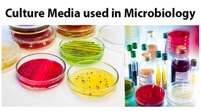 List Of Culture Media Used In Microbiology With Their Uses 