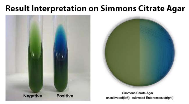 Result Interpretation on Simmons Citrate Agar