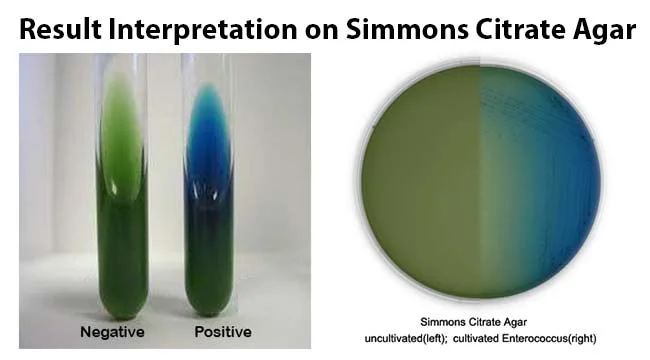 Result Interpretation on Simmons Citrate Agar