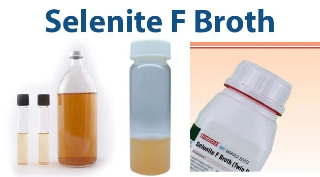 Selenite F Broth- Composition, Principle, Uses, Preparation and Result Interpretation