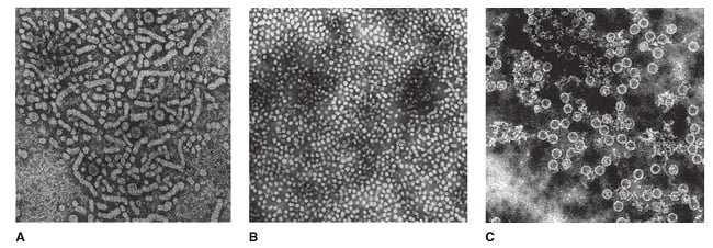 hepatitis b virus structure