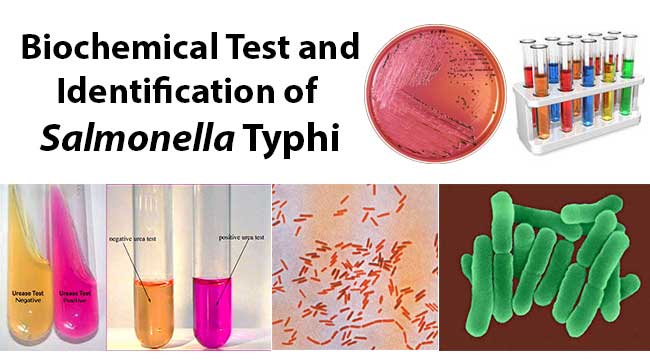Biochemical Test and Identification of Salmonella Typhi