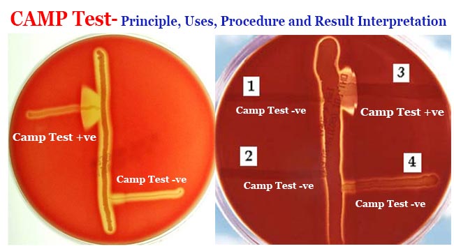 CAMP Test- Principle, Uses, Procedure and Result Interpretation