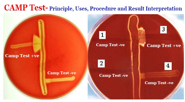 A) The CAMP test for identification of Group B streptococcus