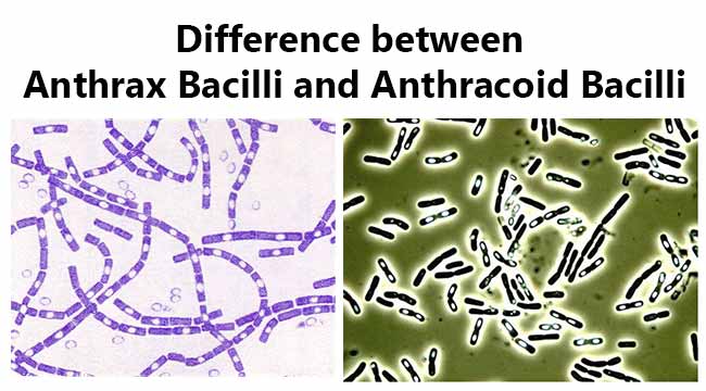 Difference between Anthrax Bacilli and Anthracoid Bacilli