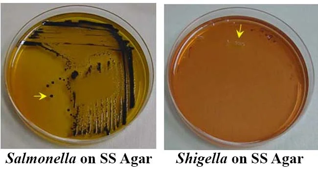 Result Interpretation on Salmonella Shigella Agar