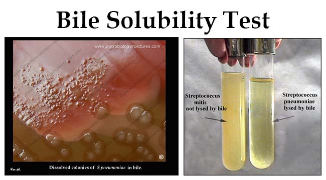 bile-solubility-test-principle-reagents-procedure-and-result