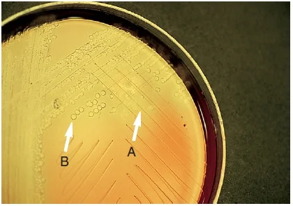 Result Interpretation of Bile Solubility Test Plate Method 1