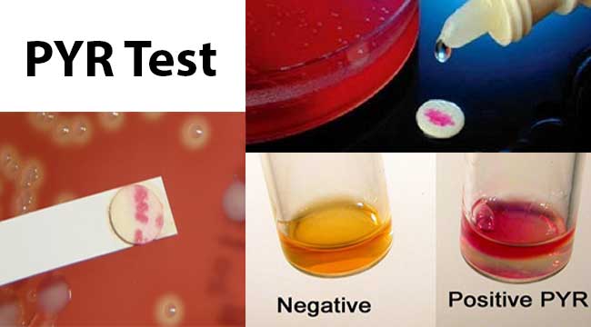 Result Interpretation of PYR Test