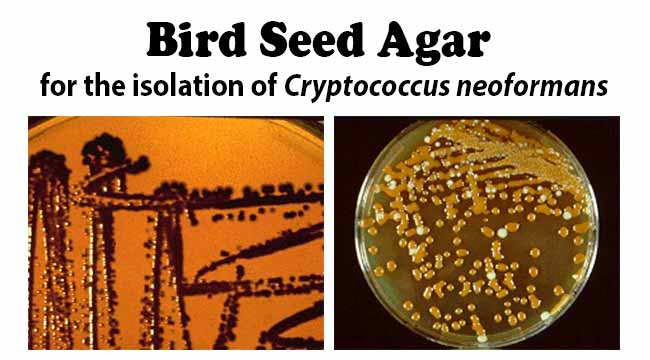 Bird Seed Agar for the isolation of Cryptococcus neoformans