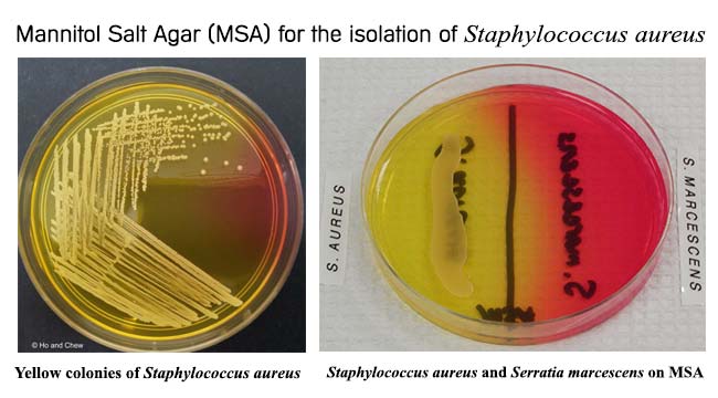 staphylococcus epidermidis streak plate