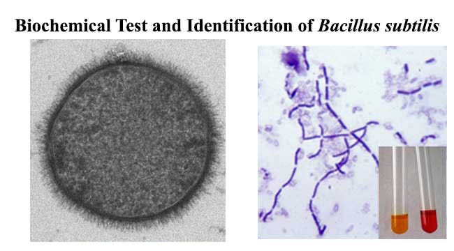 Biochemical Test and Identification of Bacillus subtilis