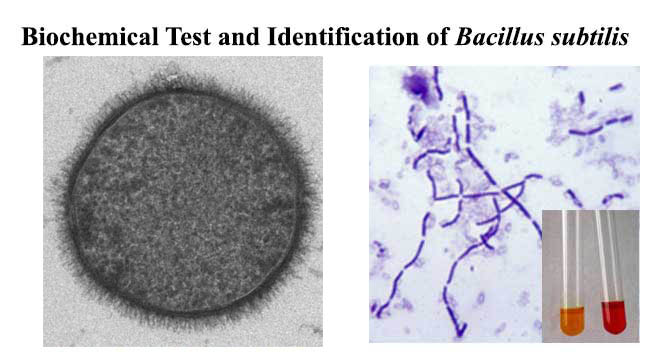 Bacillus Subtilis Identification Chart