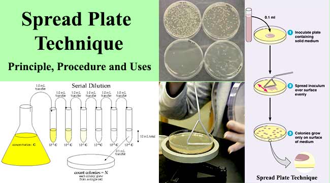 Spread Plate Technique- Principle, Procedure and Uses