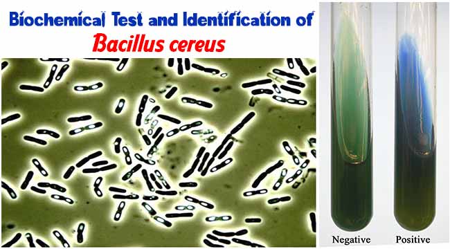 Biochemical Test and Identification of Bacillus cereus