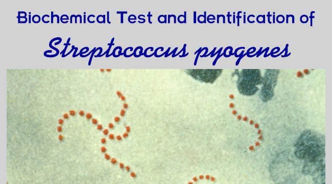 Test and Identification of Streptococcus pyogenes