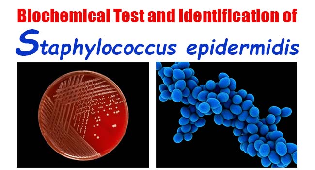 Biochemical Test and Identification of Staphylococcus epidermidis