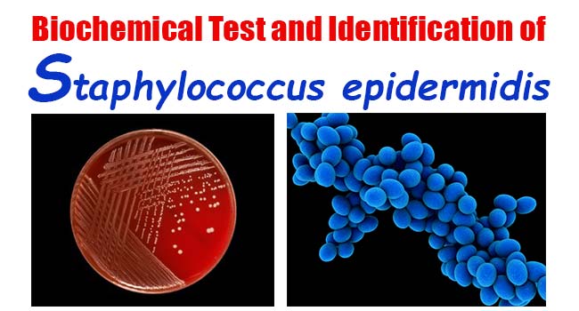 staphylococcus epidermis epidermidi