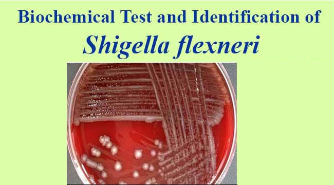 Biochemical Test and Identification of Shigella flexneri