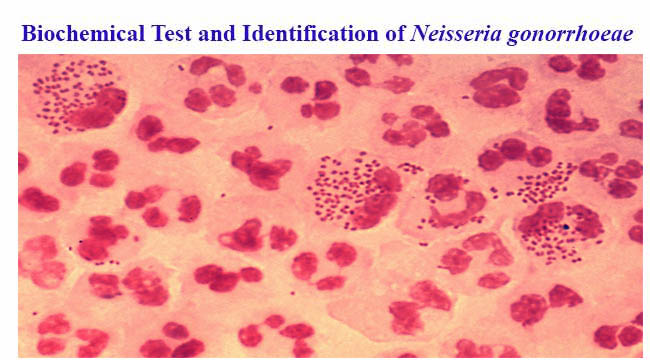 Biochemical Test and Identification of Neisseria gonorrhoeae