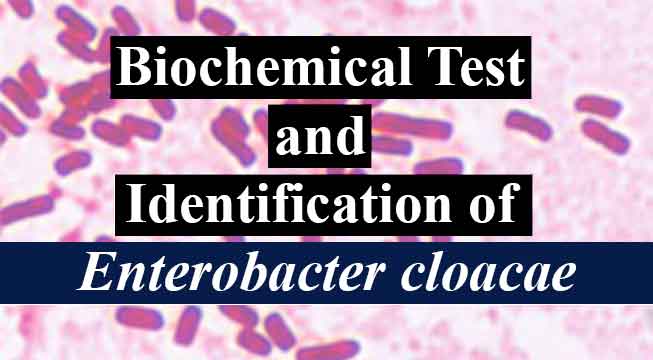 Biochemical Test and Identification of Enterobacter cloacae