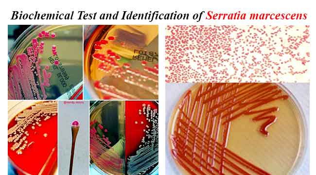 Biochemical Test and Identification of Serratia marcescens