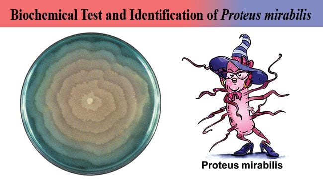 Biochemical Test and Identification of Proteus mirabilis