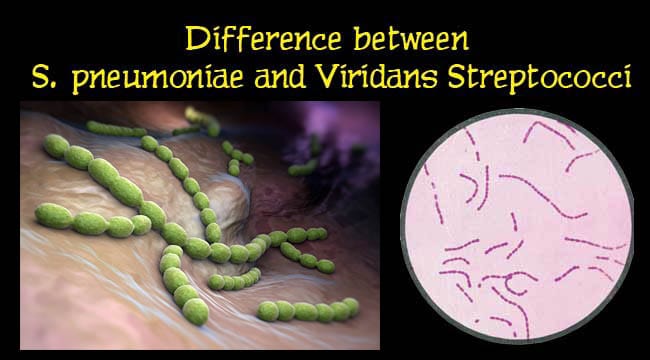Difference between S. pneumoniae and Viridans Streptococci