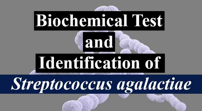 Biochemical Test and Identification of Streptococcus agalactiae