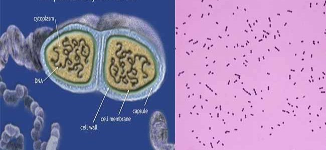 Biochemical Test and Identification of Streptococcus pneumoniae