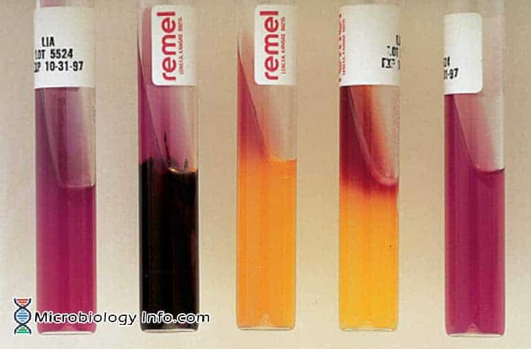 Lysine iron agar (LIA) slants test