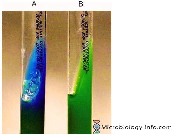 Acetate Utilization Test