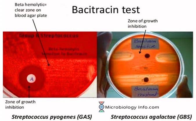 Bacitracin Susceptibility Test
