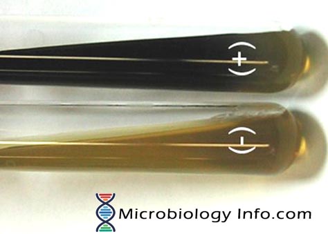 Bile Esculin Hydrolysis Test