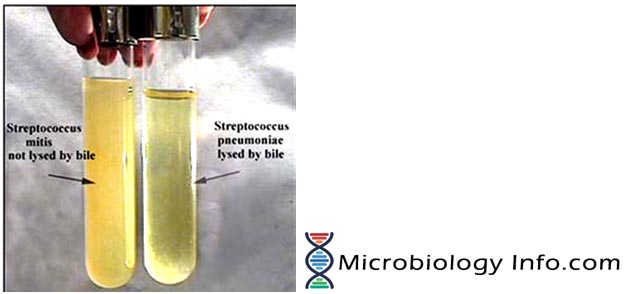 Bile Solubility Test