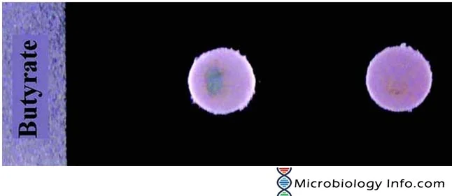 Butyrate Disk Test