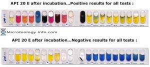 API (Analytical Profile Index) 20E Test - Procedure, Uses and ...
