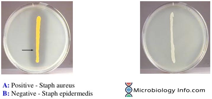 Dnase results posivite negative