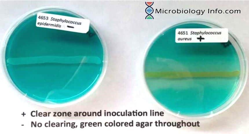 DNAse Test Agar Principle Interpretation