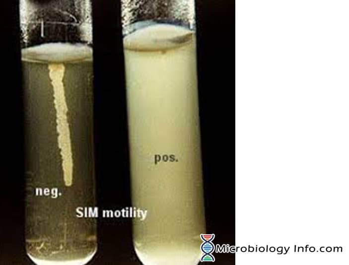 Motility Test - Principle, Procedure, Uses and Interpretation