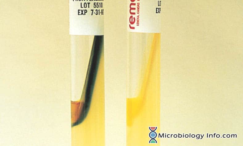 Phenylalanine Agar Test