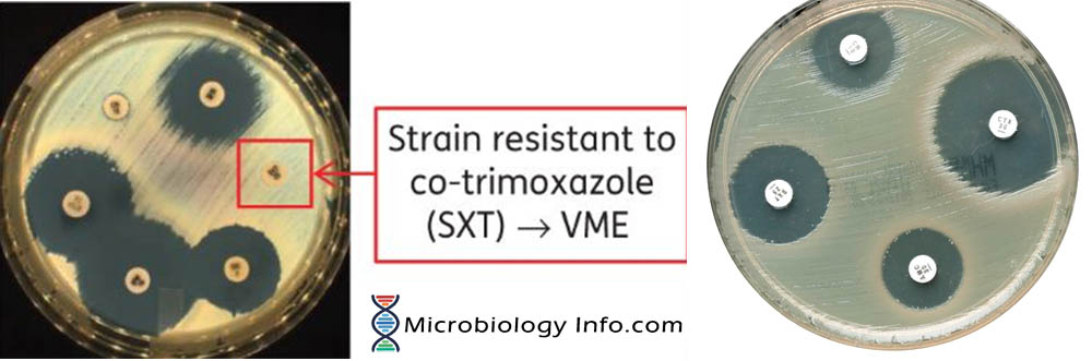 Sxt Test Principle Procedure Uses And Interpretation