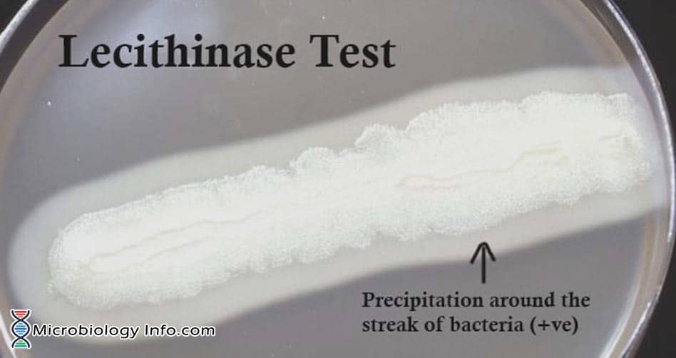 Lecithinase Test