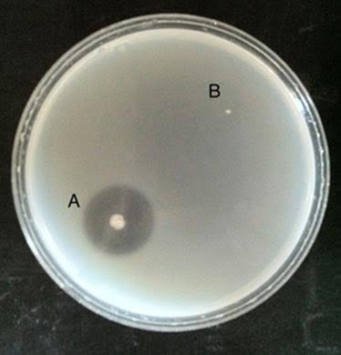 Gelatin Hydrolysis Test Results