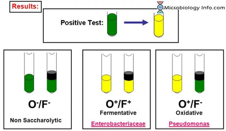 Of Oxidation Fermentation Test Procedure Uses And Interpretation 